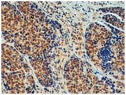 TRIM24, Goat, Polyclonal Antibody, Abnova 100 &mu;g | Buy Online | Abnova Corporation | Fisher Scientific