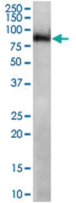 MID2, Goat, Polyclonal Antibody, Abnova 100 &mu;g | Buy Online | Abnova Corporation | Fisher Scientific