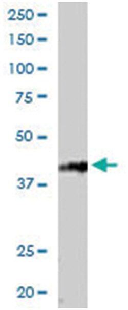 RNF2 Goat anti-Human, Polyclonal Antibody, Abnova 100 &mu;g | Buy Online | Abnova Corporation | Fisher Scientific