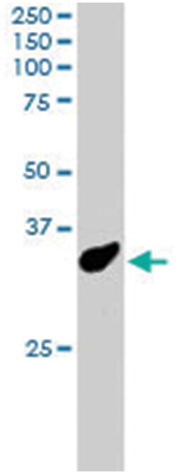 PCGF3, Goat, Polyclonal Antibody, Abnova 100&mu;g; Unlabeled:Antibodies,