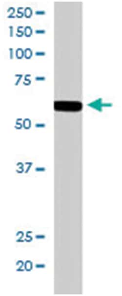 RNF8, Goat, Polyclonal Antibody, Abnova 100 &mu;g | Buy Online | Abnova Corporation | Fisher Scientific