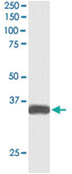 STRADB, Goat, Polyclonal Antibody, Abnova 100 &mu;g | Buy Online | Abnova Corporation | Fisher Scientific