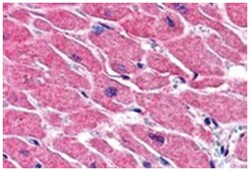 STRADB, Goat, Polyclonal Antibody, Abnova 100 &mu;g | Buy Online | Abnova Corporation | Fisher Scientific