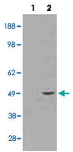 STRADB, Goat, Polyclonal Antibody, Abnova 100 &mu;g | Buy Online | Abnova Corporation | Fisher Scientific