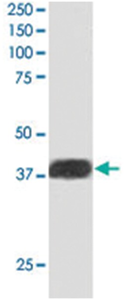 NIF3L1, Goat, Polyclonal Antibody, Abnova 100 &mu;g | Buy Online | Abnova Corporation | Fisher Scientific