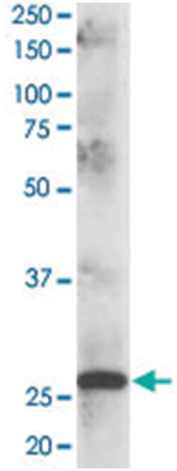 CLPP, Goat, Polyclonal Antibody, Abnova 100 &mu;g | Buy Online | Abnova Corporation | Fisher Scientific