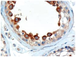 ALMS1, Goat, Polyclonal Antibody, Abnova 100 &mu;g | Buy Online | Abnova Corporation | Fisher Scientific