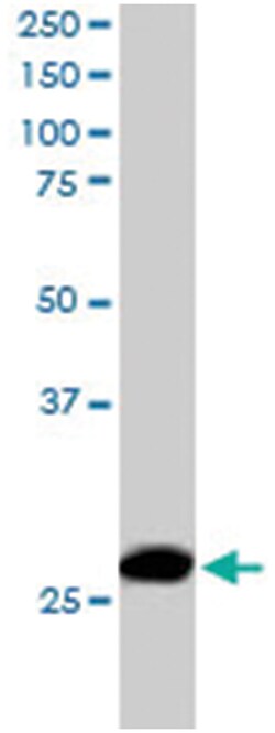 ANP32B, Goat, Polyclonal Antibody, Abnova 100 &mu;g | Buy Online | Abnova Corporation | Fisher Scientific