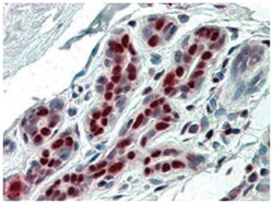 ANP32B, Goat, Polyclonal Antibody, Abnova 100 &mu;g | Buy Online | Abnova Corporation | Fisher Scientific