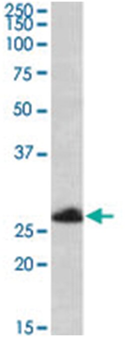 TRIM40, Goat, Polyclonal Antibody, Abnova 100&mu;g; Unlabeled:Antibodies,