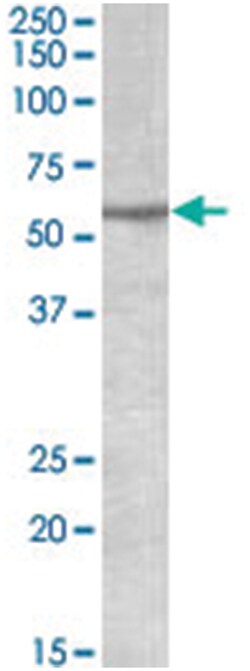 TRIM69, Goat, Polyclonal Antibody, Abnova 100&mu;g; Unlabeled:Antibodies,