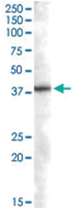 SNX16, Goat, Polyclonal Antibody, Abnova 100&mu;g; Unlabeled:Antibodies,