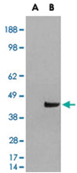 SNX16, Goat, Polyclonal Antibody, Abnova 100&mu;g; Unlabeled:Antibodies,