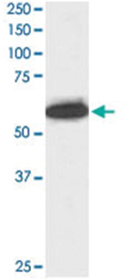 NUP50, Goat, Polyclonal Antibody, Abnova 100&mu;g; Unlabeled:Antibodies,