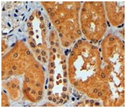 TRIM11 Goat anti-Human, Polyclonal Antibody, Abnova 100 &mu;g | Buy Online | Abnova Corporation | Fisher Scientific