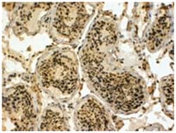 UBR5 (EDD1), Goat, Polyclonal Antibody, Abnova 100 &mu;g | Buy Online | Abnova Corporation | Fisher Scientific