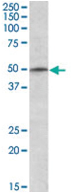 TRIM35, Goat, Polyclonal Antibody, Abnova 100 &mu;g | Buy Online | Abnova Corporation | Fisher Scientific
