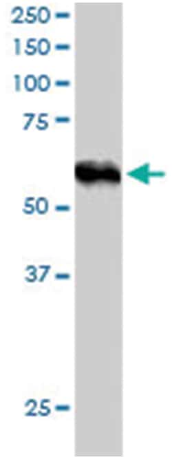 TRIM4, Goat, Polyclonal Antibody, Abnova 100 &mu;g | Buy Online | Abnova Corporation | Fisher Scientific