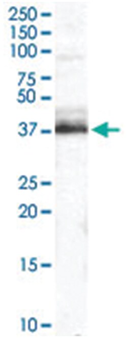 TRIM5 Goat anti-Human, Polyclonal Antibody, Abnova 100 &mu;g | Buy Online | Abnova Corporation | Fisher Scientific