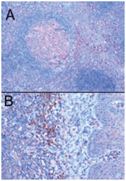TRIM5 Goat anti-Human, Polyclonal Antibody, Abnova 100 &mu;g | Buy Online | Abnova Corporation | Fisher Scientific