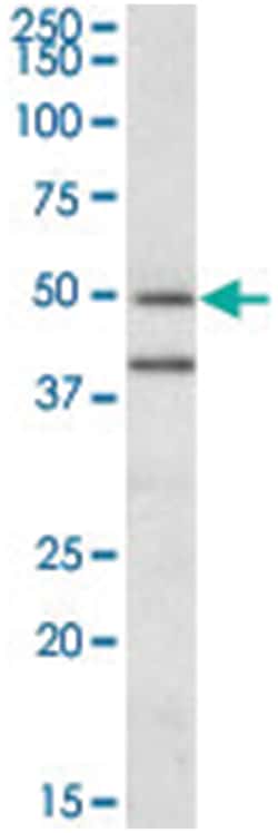 TRAIP, Goat, Polyclonal Antibody, Abnova 100 &mu;g | Buy Online | Abnova Corporation | Fisher Scientific