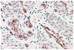 RIG, Goat, Polyclonal Antibody, Abnova 100 &mu;g | Buy Online | Abnova Corporation | Fisher Scientific