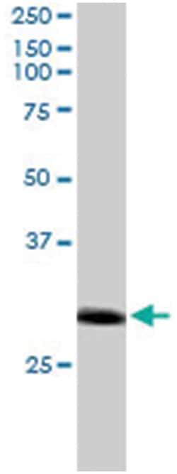 RNF141, Goat, Polyclonal Antibody, Abnova 100 &mu;g | Buy Online | Abnova Corporation | Fisher Scientific