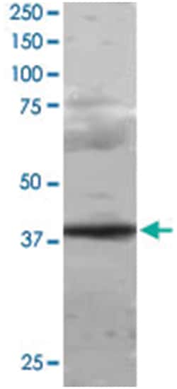 PCGF2, Goat, Polyclonal Antibody, Abnova 100 &mu;g | Buy Online | Abnova Corporation | Fisher Scientific