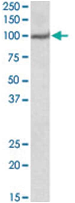 USP4, Goat, Polyclonal Antibody, Abnova 100&mu;g; Unlabeled:Antibodies,