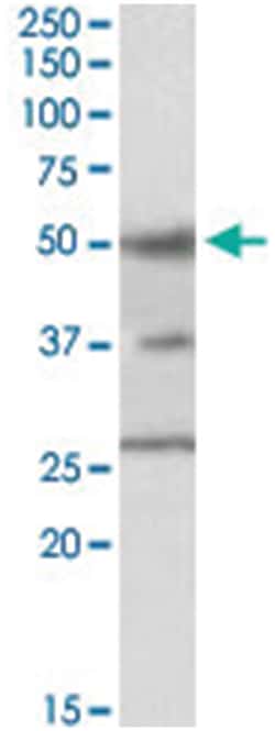 FOXA1, Goat, Polyclonal Antibody, Abnova 100&mu;g; Unlabeled:Antibodies,