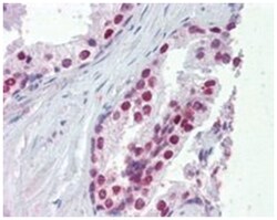 FOXA1, Goat, Polyclonal Antibody, Abnova 100&mu;g; Unlabeled:Antibodies,