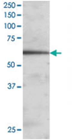 FOXA2, Goat, Polyclonal Antibody, Abnova 100 &mu;g | Buy Online | Abnova Corporation | Fisher Scientific