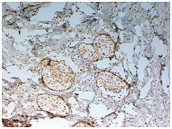 FOXC2, Goat, Polyclonal Antibody, Abnova 100 &mu;g | Buy Online | Abnova Corporation | Fisher Scientific