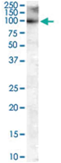 MYRIP, Goat, Polyclonal Antibody, Abnova 100 &mu;g | Buy Online | Abnova Corporation | Fisher Scientific