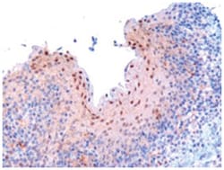 RANBP9, Goat, Polyclonal Antibody, Abnova 100 &mu;g | Buy Online | Abnova Corporation | Fisher Scientific