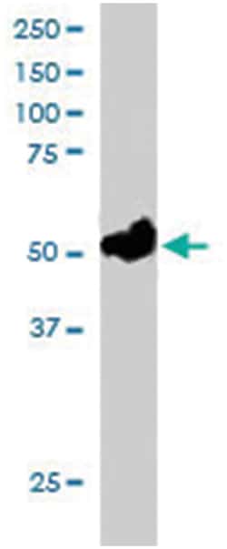FOXQ1, Goat, Polyclonal Antibody, Abnova 100&mu;g; Unlabeled:Antibodies,