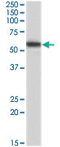 FAF2, Goat, Polyclonal Antibody, Abnova 100 &mu;g | Buy Online | Abnova Corporation | Fisher Scientific