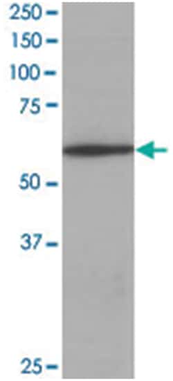 CORO1A, Goat, Polyclonal Antibody, Abnova 100 &mu;g | Buy Online | Abnova Corporation | Fisher Scientific