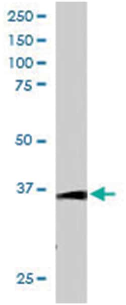 TCF19, Goat, Polyclonal Antibody, Abnova 100 &mu;g | Buy Online | Abnova Corporation | Fisher Scientific
