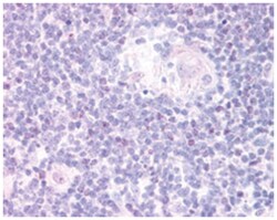 FOXN1, Goat, Polyclonal Antibody, Abnova 100 &mu;g | Buy Online | Abnova Corporation | Fisher Scientific