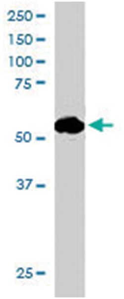 SIL1, Goat, Polyclonal Antibody, Abnova 100 &mu;g | Buy Online | Abnova Corporation | Fisher Scientific