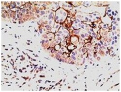 EPS8, Goat, Polyclonal Antibody, Abnova 100 &mu;g | Buy Online | Abnova Corporation | Fisher Scientific