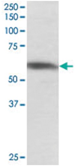 PTBP1, Goat, Polyclonal Antibody, Abnova 100 &mu;g | Buy Online | Abnova Corporation | Fisher Scientific
