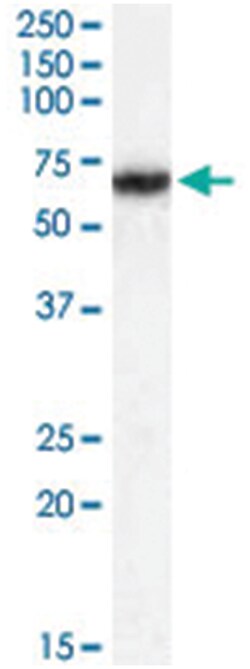 FANCG, Goat, Polyclonal Antibody, Abnova 100 &mu;g | Buy Online | Abnova Corporation | Fisher Scientific