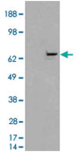 FANCG, Goat, Polyclonal Antibody, Abnova 100 &mu;g | Buy Online | Abnova Corporation | Fisher Scientific