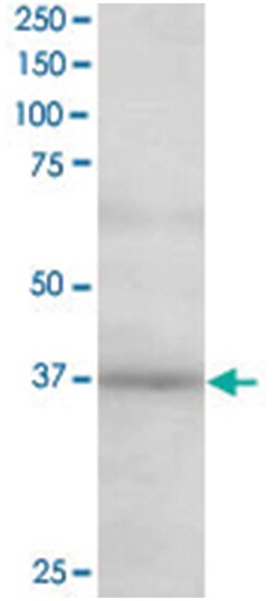 ATP6IP2, Goat, Polyclonal Antibody, Abnova 100&mu;g; Unlabeled:Antibodies,