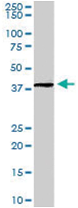 ADAP1, Goat, Polyclonal Antibody, Abnova 100&mu;g; Unlabeled:Antibodies,