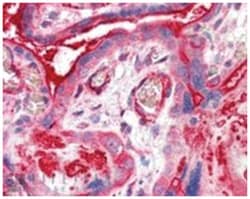 ADAP2, Goat, Polyclonal Antibody, Abnova 100 &mu;g | Buy Online | Abnova Corporation | Fisher Scientific