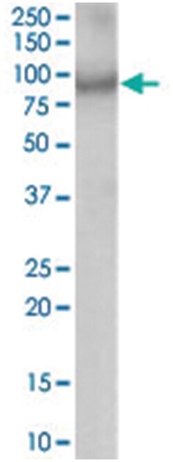ACAP2, Goat, Polyclonal Antibody, Abnova 100 &mu;g | Buy Online | Abnova Corporation | Fisher Scientific