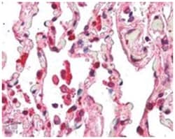 ACAP2, Goat, Polyclonal Antibody, Abnova 100 &mu;g | Buy Online | Abnova Corporation | Fisher Scientific